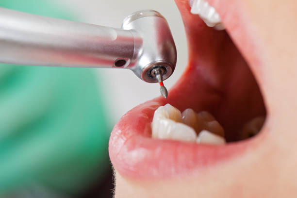 Best Emergency Dental Care for Abscessed Tooth in Farmersville, OH